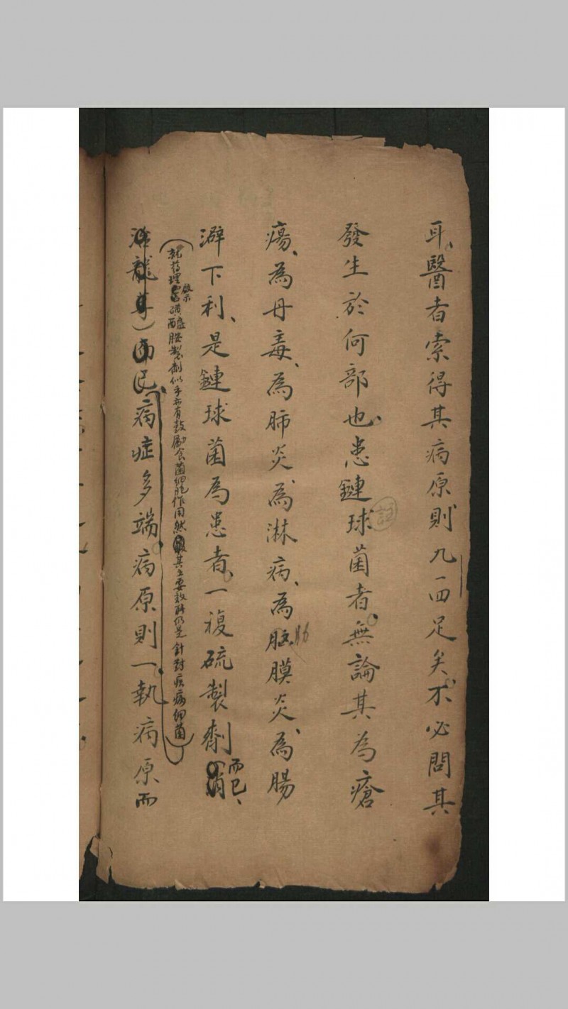 祝味菊 陈苏生伤寒质难 , 1943