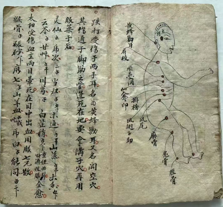 中医跌打古籍《五百钱点解穴秘传 》(图6)